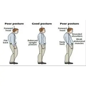 2. Postur yang buruk