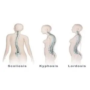 Akibat Pemakaian Bra yang Salah