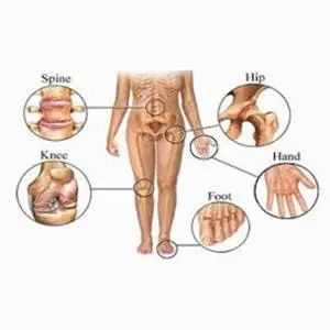 Pengapuran vs Pengeroposan Tulang