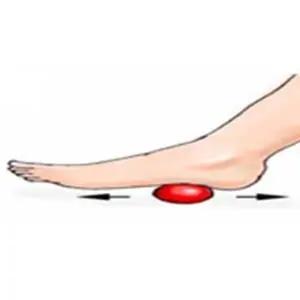 Ketahui Gejala Flat Foot (Kaki Datar) dan Cara Mengatasinya