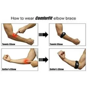 Cedera Olahraga Golfer Syndrome, Tennis Elbow dan Penanganannya