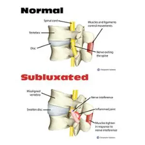 Penanganan Cedera Olahraga Dengan Tulang Belakang, Otot dan Persendian
