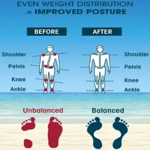 Cedera Ringan Berakibat Fatal Bagi Tulang Belakang